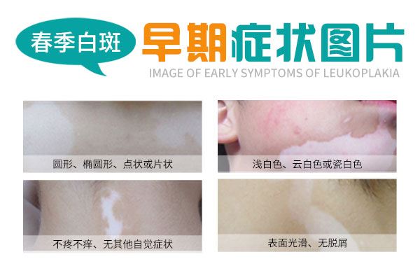 怎么样能保持皮肤的白斑